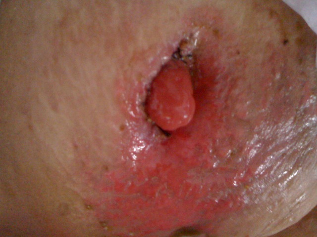 Dr.Kashid Hospital & Piles Clinic